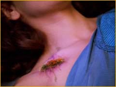 Blessure du Conseiller Troi