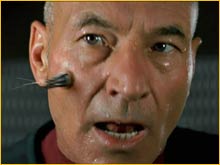 Implant Borg