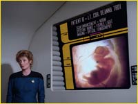 Pulaski, échographie 