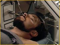 Stimulation neurale